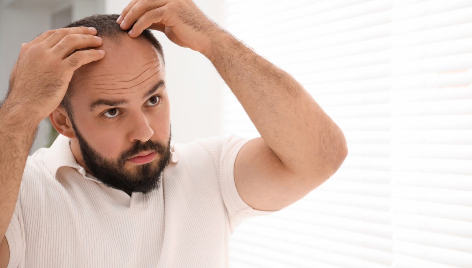 تكلفة زراعة الشعر في مقدمة الرأس