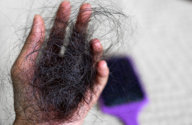 أسئلة شائعة عن علاج تساقط الشعر