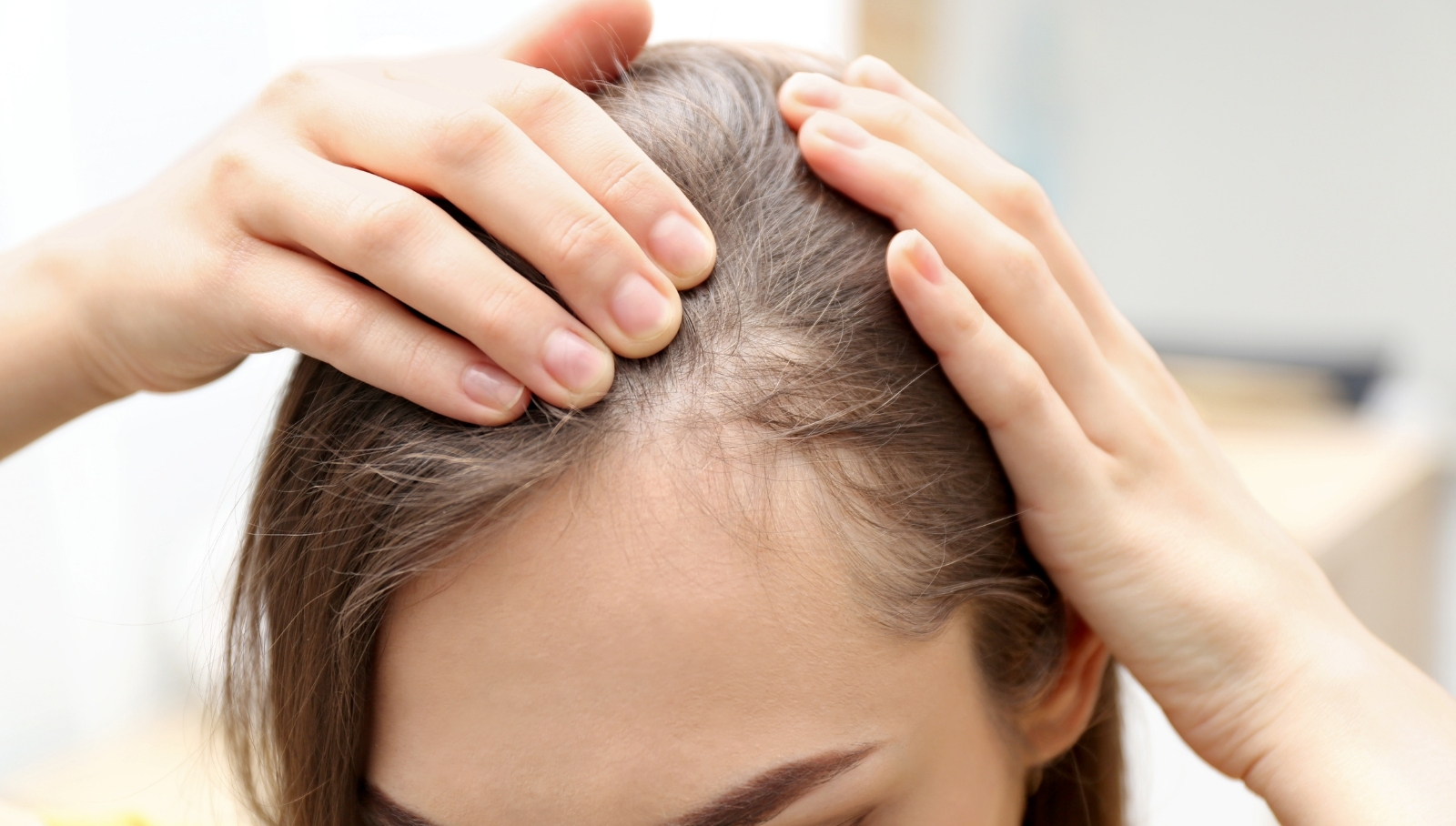 زراعة شعر مقدمة الرأس للنساء