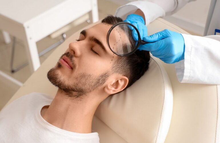 تعليمات بعد زراعة الشعر في مصر