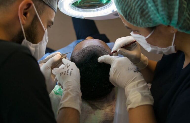 أفضل مركز زراعة شعر في مصر