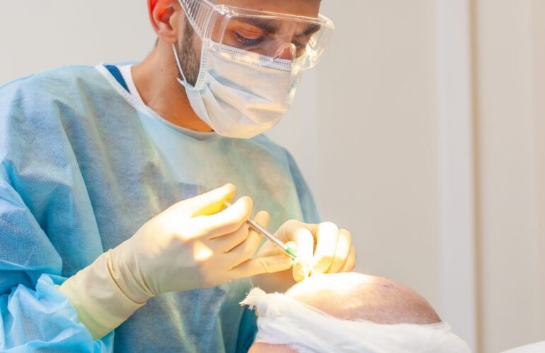 افضل دكتور زراعة شعر