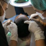 ما هي افضل دولة لزراعة الشعر