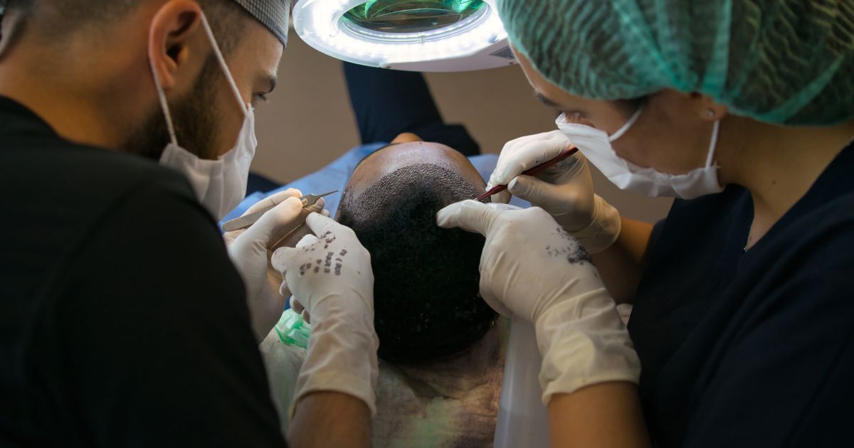 ما هي افضل دولة لزراعة الشعر