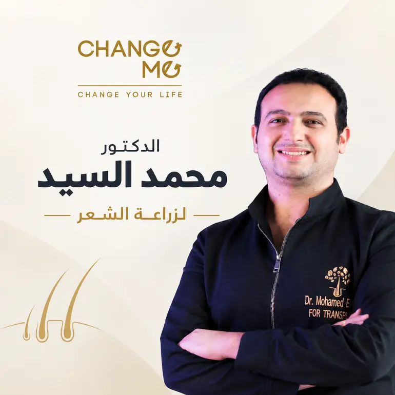 دكتور محمد السيد طبيب لزراعة الشعر